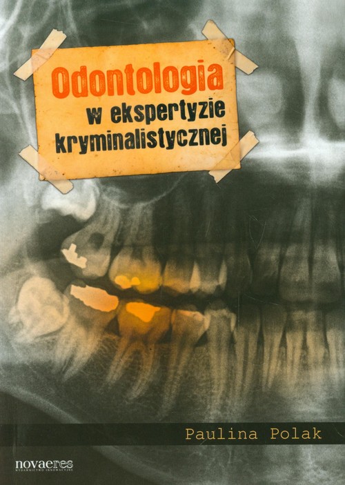 Image of Odontologia w ekspertyzie kryminalistycznej
