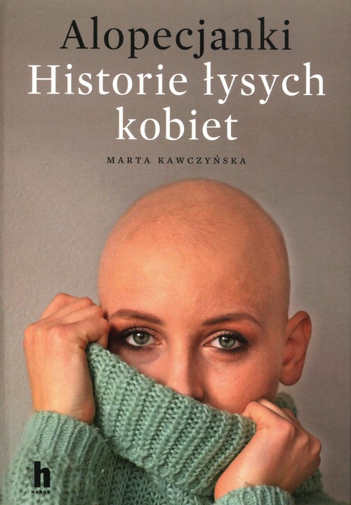 Image of Alopecjanki Historie łysych kobiet