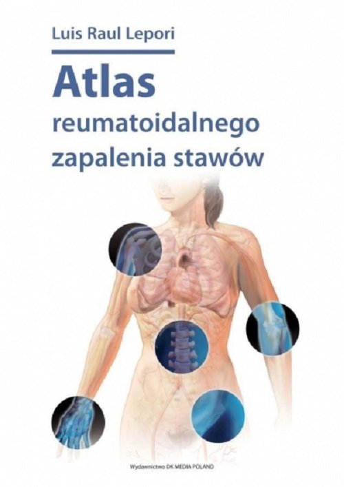 Image of Atlas reumatoidalnego zapalenia stawów / DK Media