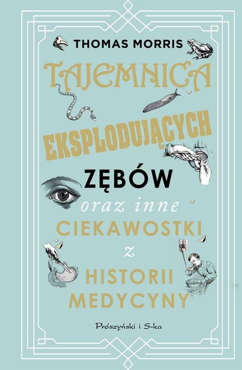 Image of Tajemnica eksplodujących zębów oraz inne ciekawostki z historii medycyny