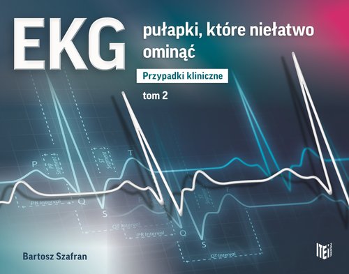 Image of EKG pułapki, które niełatwo ominąć Przypadki kliniczne tom 2