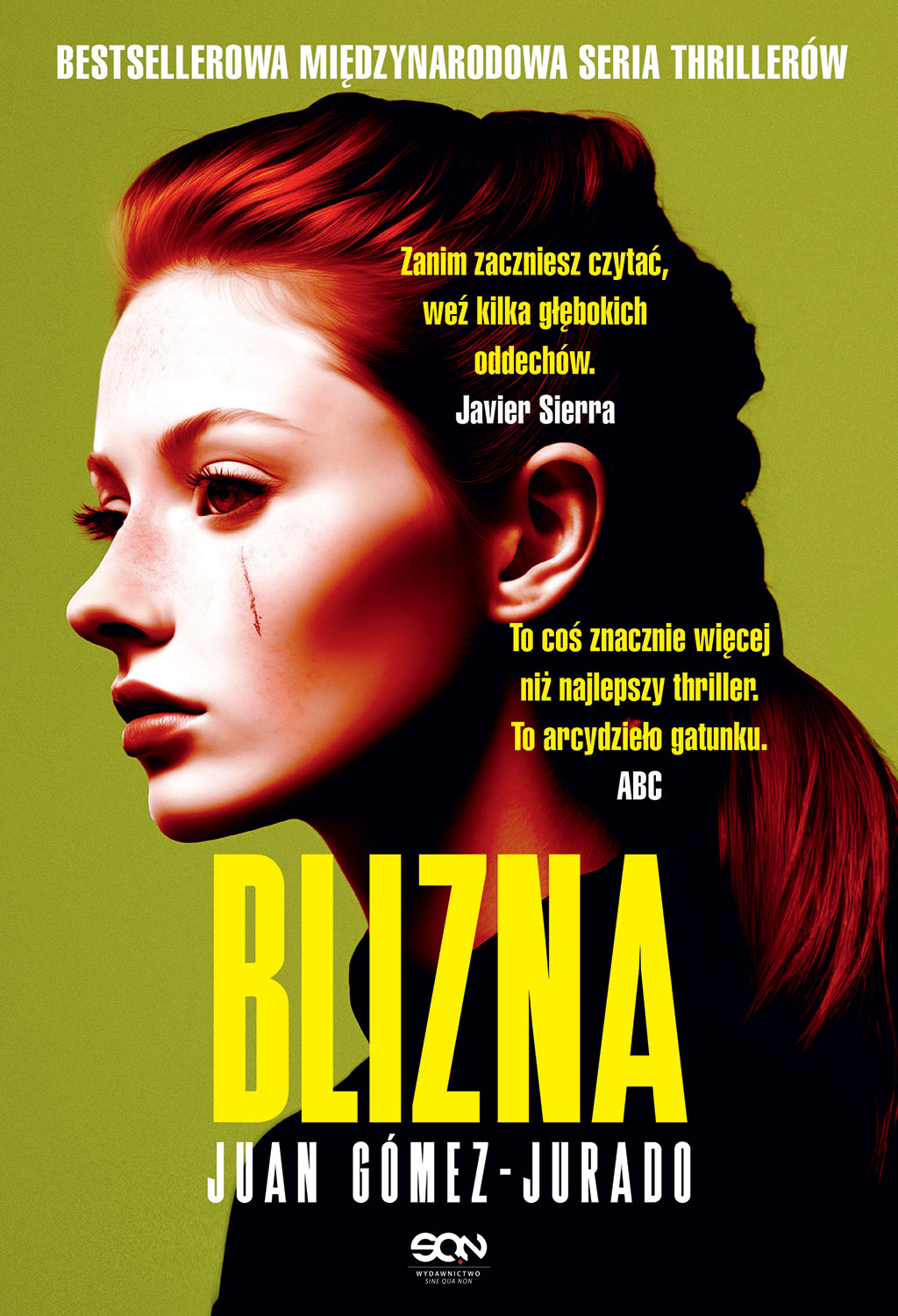 Image of Blizna