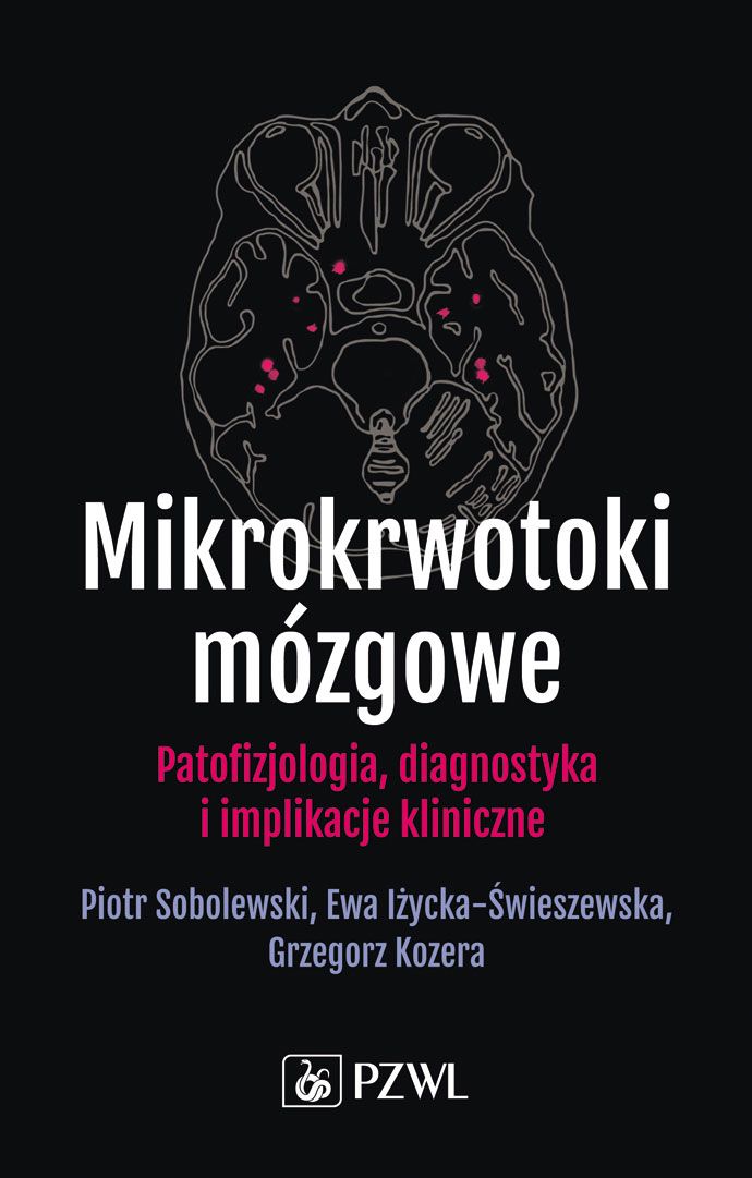 Image of Mikrokrwotoki mózgowe. Patofizjologia, diagnostyka i implikacje kliniczne